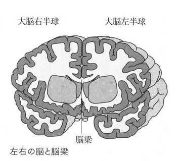 脳梁２.jpg